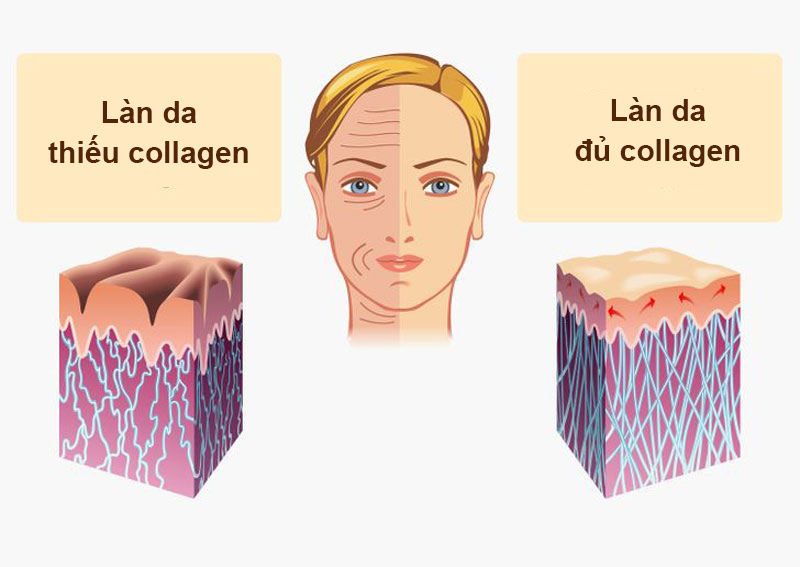 Collagen và những lợi ích bạn chưa biết